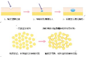 台湾全脸微雕除皱术