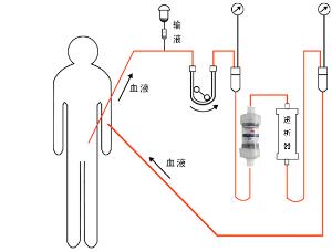 yts100一次性使用血液灌流器