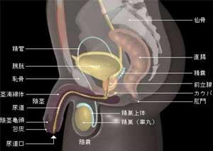 前列腺发炎