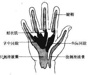 腱鞘炎症