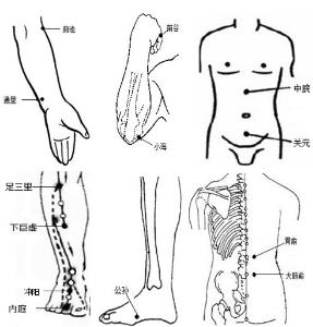 拔罐作用的原理是什么_拔火罐时,拔出的水泡到底是什么?(2)