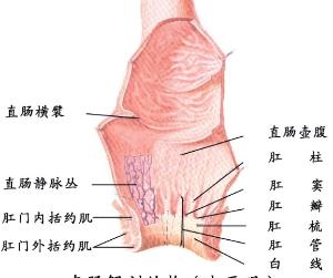 直肠脱垂症