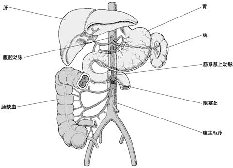 肠系膜上动脉