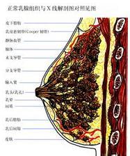 起源于<em>乳腺</em>上皮组织的恶性肿瘤被称为<em>乳腺</em>癌;