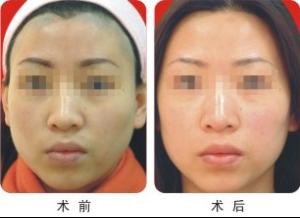 发际线+-+搜搜百科