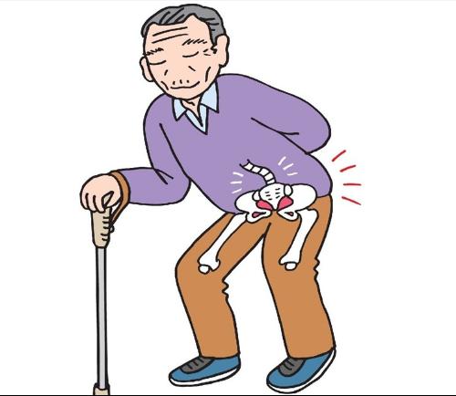 急性腰扭伤