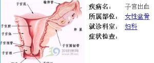 诊断性刮宫