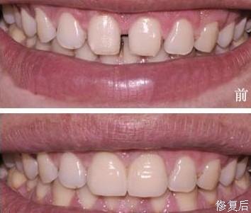 口腔正畸+-+搜狗百科