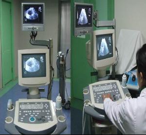 微管人流术+-+搜狗百科