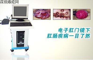 <em>痔疮的最佳治疗方法</em> 深圳_痔疮的症状图片_女