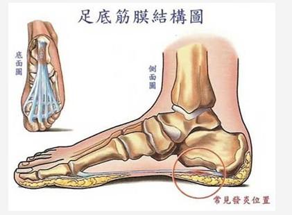 跖筋膜为足底腱膜的一部分