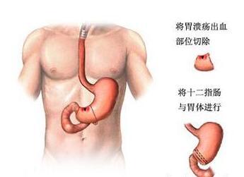 武汉博仕胃肠医院