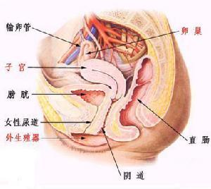 女性宫内膜炎