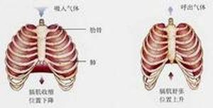 膈肌膨出