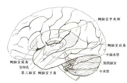 第四脑室肿瘤