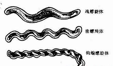 螺旋体病什么意思 20130428130207-31049313.jpg