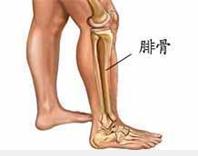 腓骨肌萎缩症-+搜狗百科