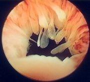 一点是上述症状既发生于晚间