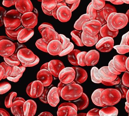 先天性红细胞膜病-+搜搜百科