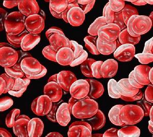 单纯红细胞再障性贫血-+搜搜百科