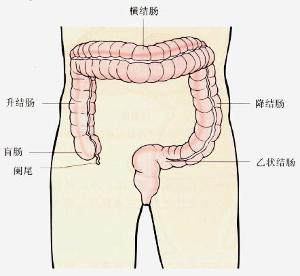 小肠结肠炎