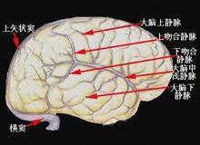 上矢状窦血栓性静脉炎