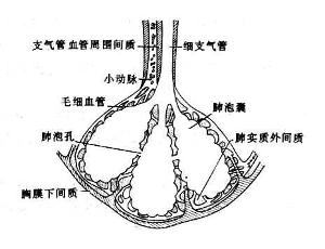 肺间质病