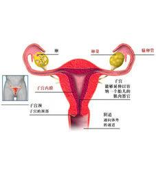 <em>外阴</em>癌-+搜搜百科