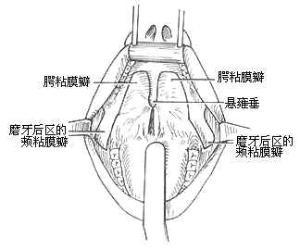 软腭癌占原发腭部恶性肿瘤的13.5.