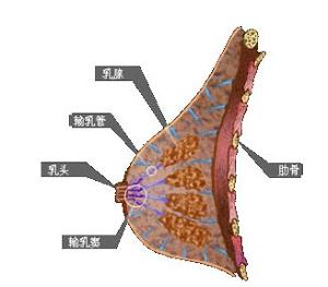 ②乳腺癌:是最常见的恶性肿瘤,早期为无痛性单发的肿块,生长速度快