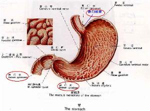 胃窦狭窄