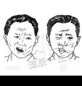 在生活上面瘫的具体分析