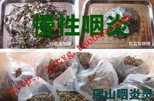 瑶山咽炎灵治疗慢性咽炎