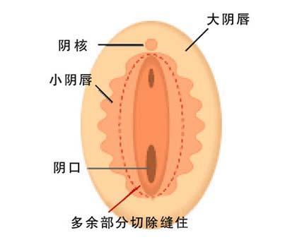 编辑词条