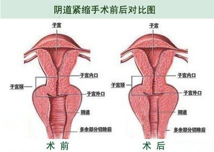 <em>女性</em>生殖<em>整形</em>+-+搜搜百科