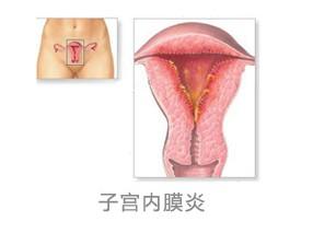 <em>女性阴道</em>呈酸性环境