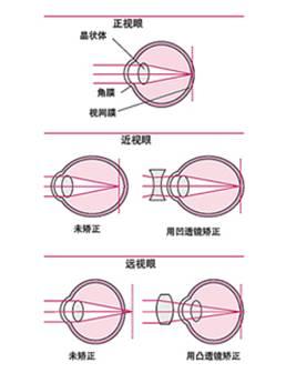 远视原理