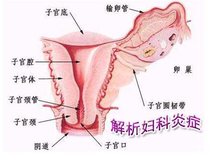 牛仔裤易引发阴道炎+阴道炎是最常见得女性生殖