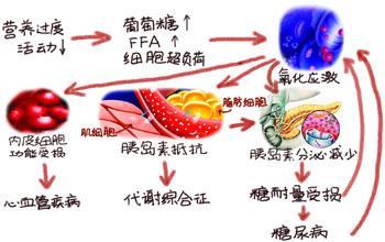 2型糖尿病