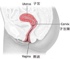 子宫后位