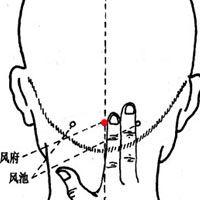 风府穴