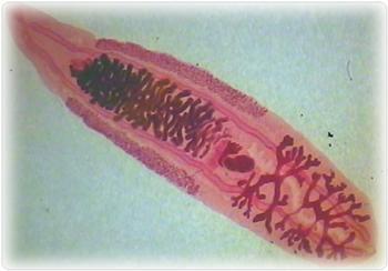 食源性寄生虫病