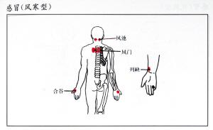 风寒感冒:后头穴位—背部穴位—上肢内侧—上肢外侧;; 背部刮痧示意
