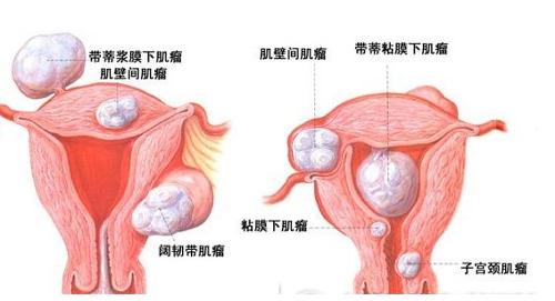 <em>阴道</em>出血 - 搜搜百科