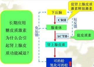 研究糖皮质激素护理牛皮癣对身体危害有哪些