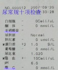 尿常规检查