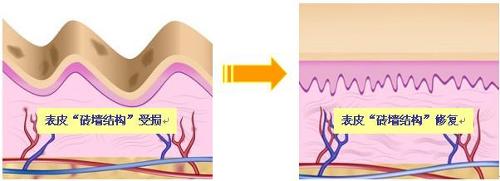 立体焕肤即是从内到外,全面的解决皮肤表层,真皮层的结构重建