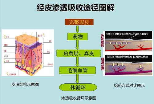 经皮给药方式示意图