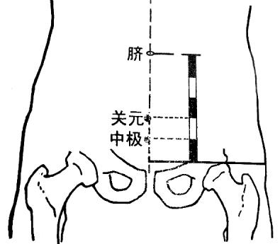 见图2-3-4---2-3-5.; 患前列腺炎按揉关元穴 中极穴