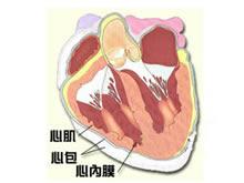 导致慢性心包积液的病因有多种